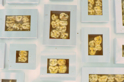 Stopgap for G-Spotts